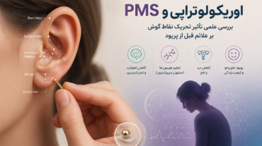 اوریکولوتراپی و PMS - بررسی علمی تأثیر تحریک نقاط گوش بر علائم قبل از پریود