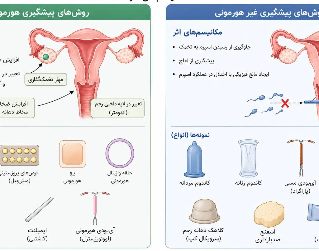 پیشگیری هورمونی یا غیرهورمونی؟ - کدام مناسب شماست