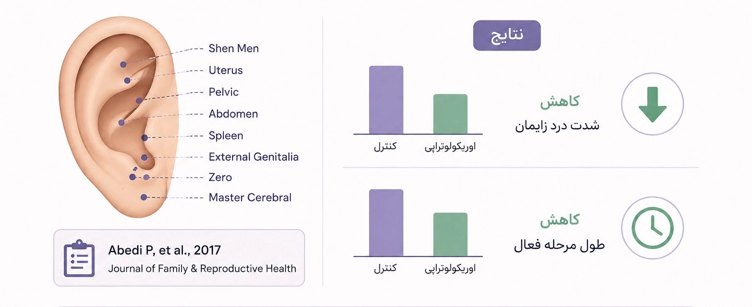 نتایج مطالعه ایرانی درباره اوریکولوتراپی و درد زایمان