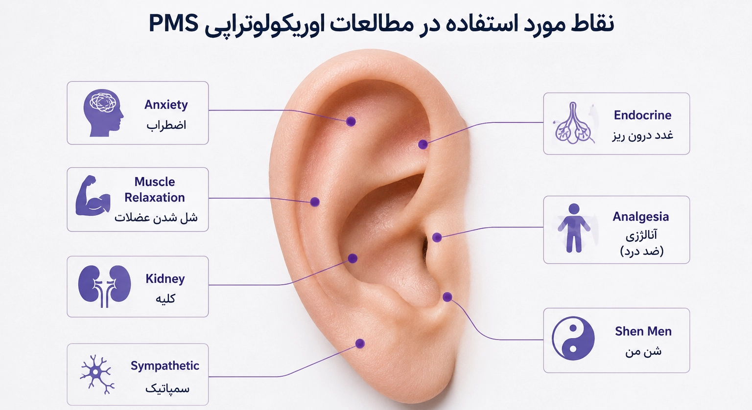 نقاط مورد استفاده در مطالعات اوریکولوتراپی PMS