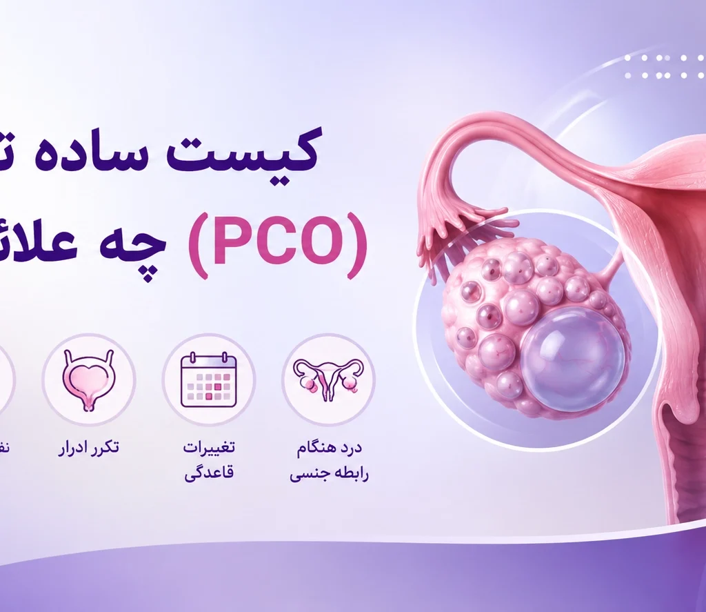 کیست ساده تخمدان (PCO) چه علائمی دارد؟