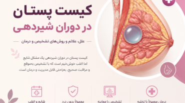 کیست پستان در دوران شیردهی چیست؟