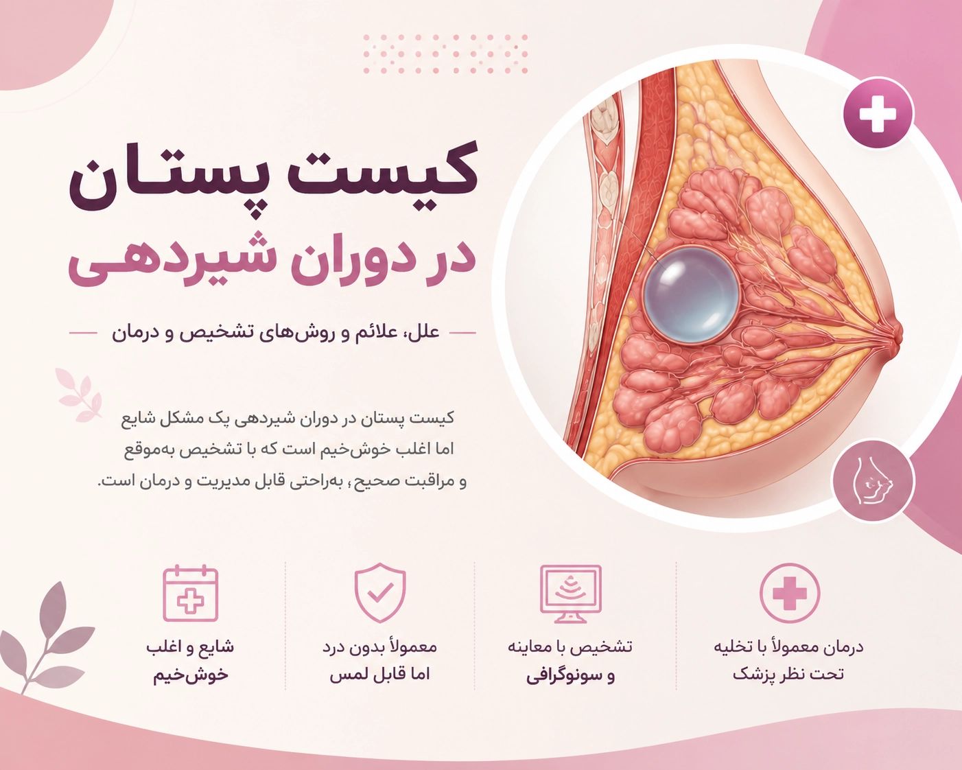 کیست پستان در دوران شیردهی چیست؟