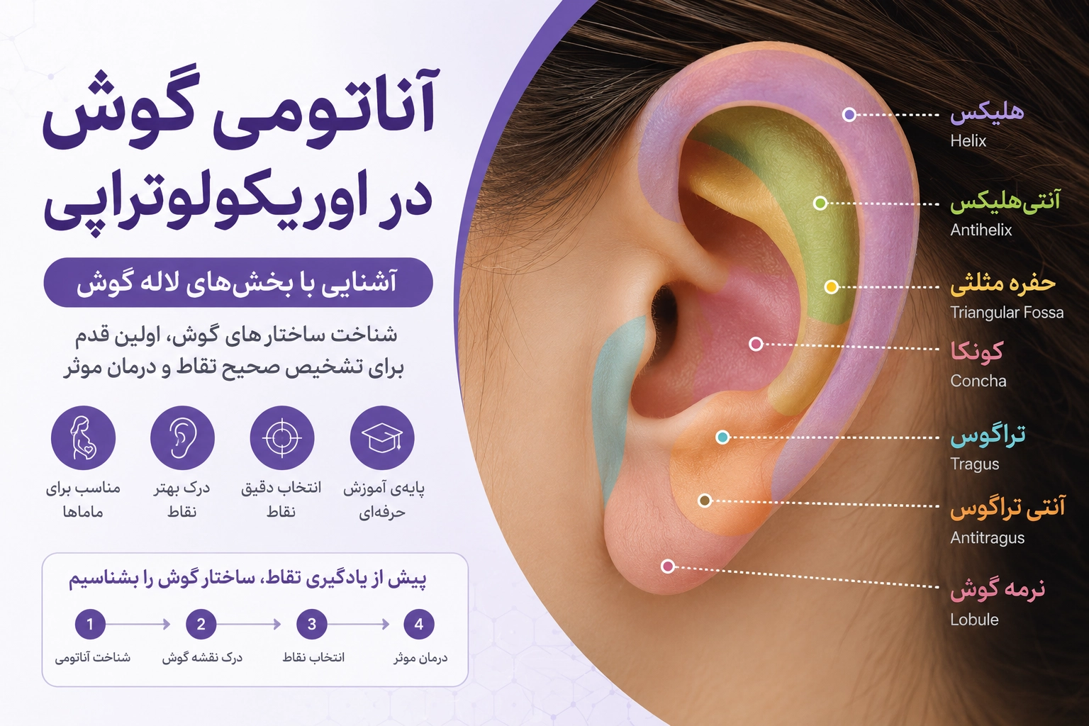 نقشه برچسب‌دار لاله گوش؛ محل هلیکس، آنتی‌هلیکس، حفره مثلثی، کونکا، تراگوس، آنتی‌تراگوس و نرمه گوش