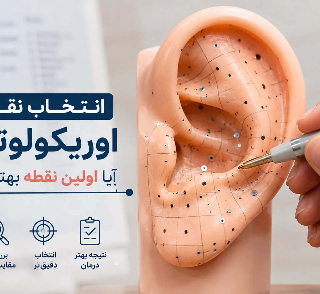 انتخاب نقاط اوریکولوتراپی؛ آیا اولین نقطه بهترین است؟
