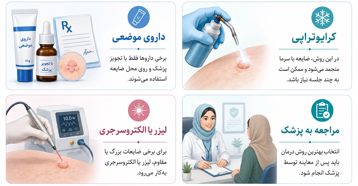 درمان زگیل تناسلی چگونه انجام می‌شود؟