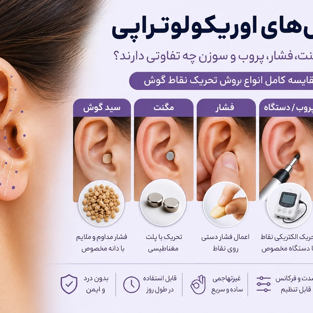 روش‌های اوریکولوتراپی؛ مقایسه سید، مگنت، فشار، پروب و سوزن