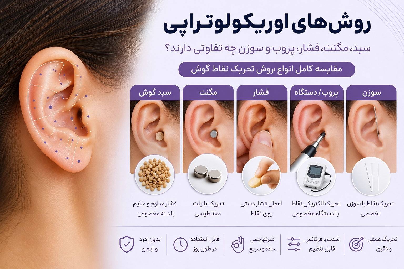روش‌های اوریکولوتراپی؛ مقایسه سید، مگنت، فشار، پروب و سوزن