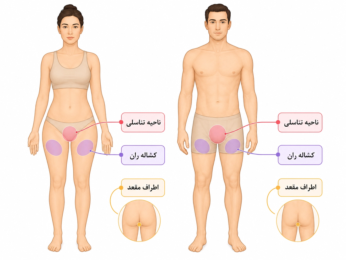 زگیل تناسلی چه شکلی است؟