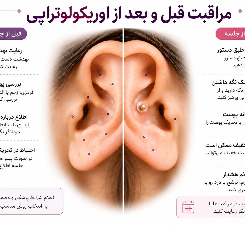 مراقبت قبل و بعد از اوریکولوتراپی